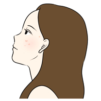 シミの悩み